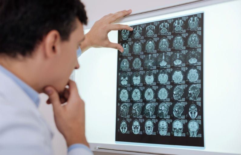 Telemedicina na Neurologia Telemedicina na Neurologia
