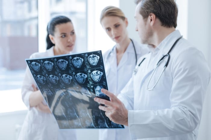 Em que casos vou precisar da telemedicina na neurologia?