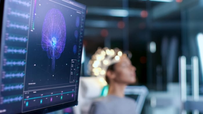 Qual a importância da telemedicina na neurologia?