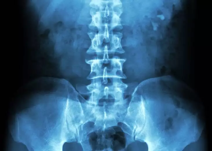 radiografia abdomen