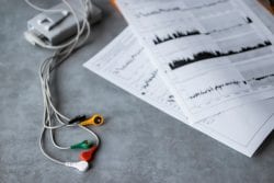 interpretar resultados holter