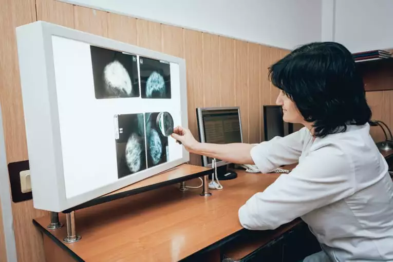 interpretação da mamografia bi-rads