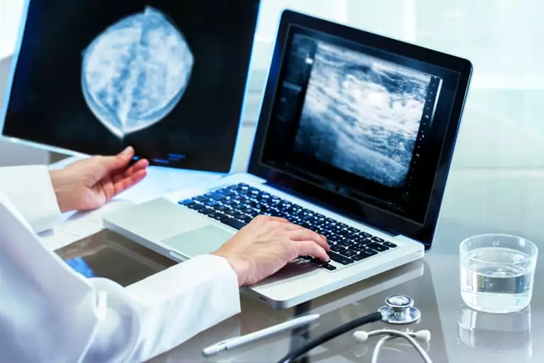 Interpretação de mamografia e ecografia