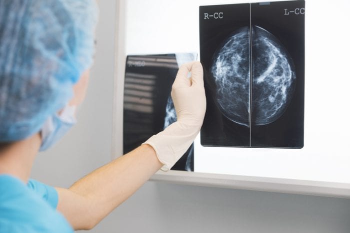 Interpretação da Mamografia: como interpretar a classificação BI-RADS