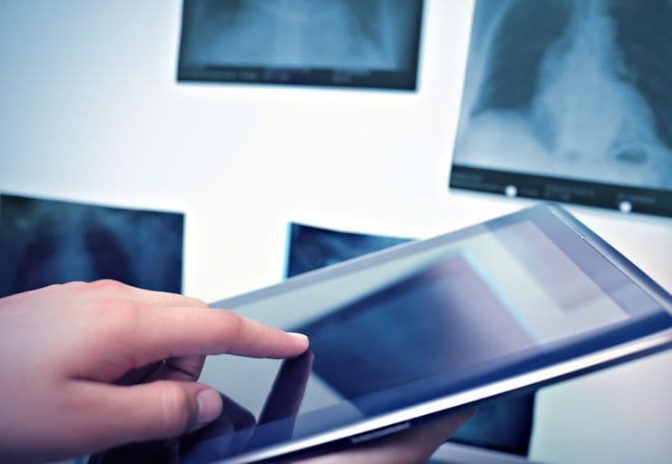 laudo de angiotomografia no tablet