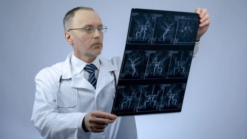 Médico com um filme de angiotomografia na mão