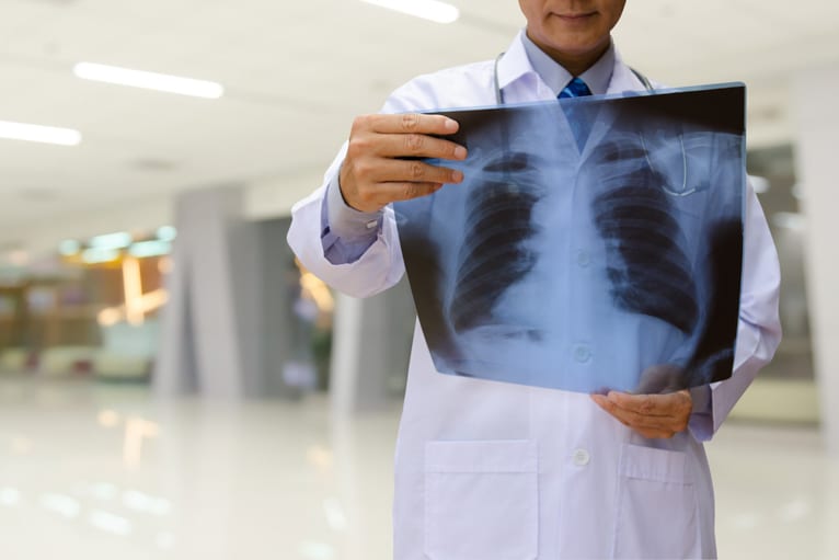 Médico interpretando um rx de tórax