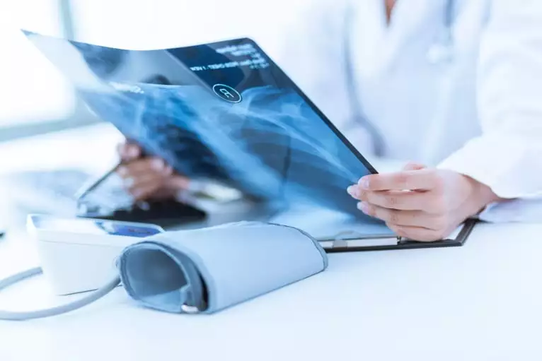 equipamento de raio x, radiografia de tórax