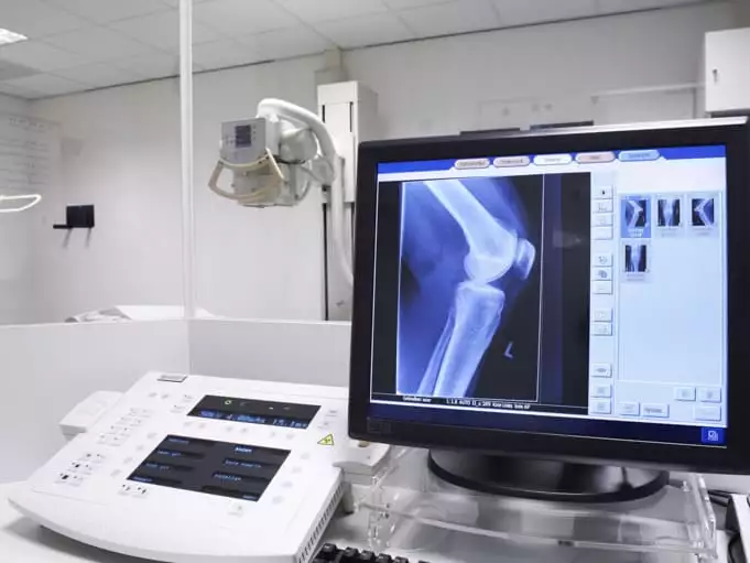 tecnologia na medicina dentro da sala de radiologia