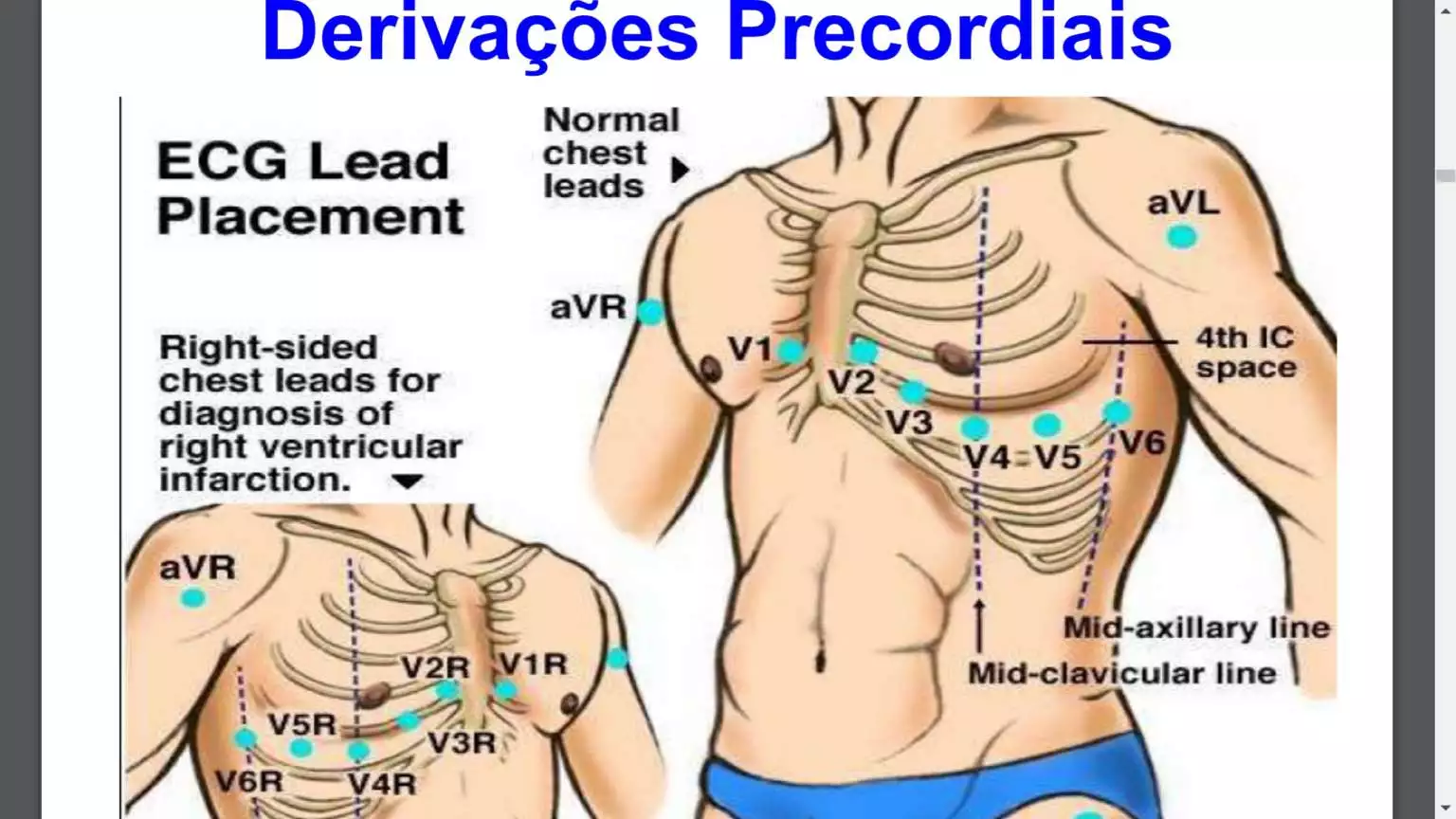 Posições Dos Eletrodos Para Ecg ENSINO