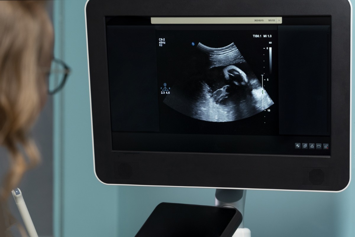 O ecocardiograma fetal costuma ser realizado por um cardiologista fetal Ecocardiograma fetal