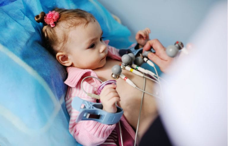 Eletrocardiograma infantil: o que é e para que serve o ECG pediátrico