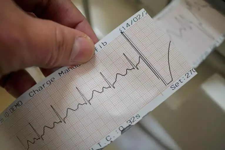Como calcular o eixo elétrico do coração?
