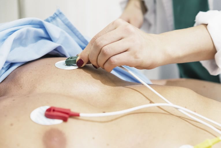 Como funcionam os eletrodos do ECG