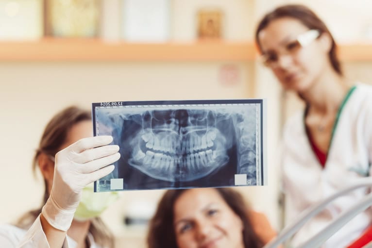 O que é e para que serve o raio x ou radiografia