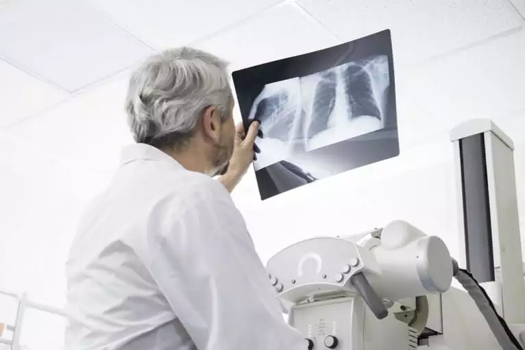 Tipos de raio x: para que serve e principais tipos de radiografia