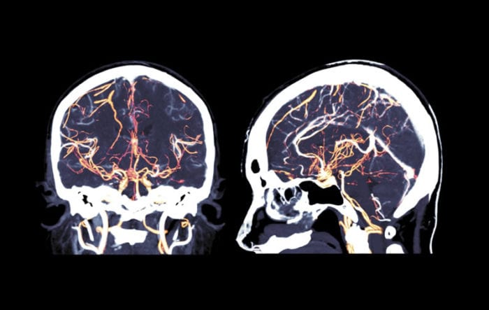 Ressonância magnética com contraste: como é feita, doenças e riscos