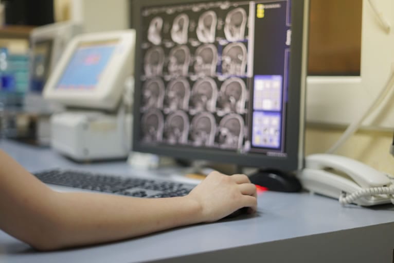 Médico vendo imagens de ressonância magnética com contraste na tela do computador