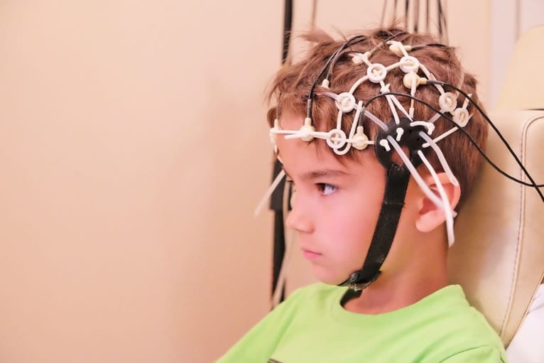 Vantagens do EEG Infantil