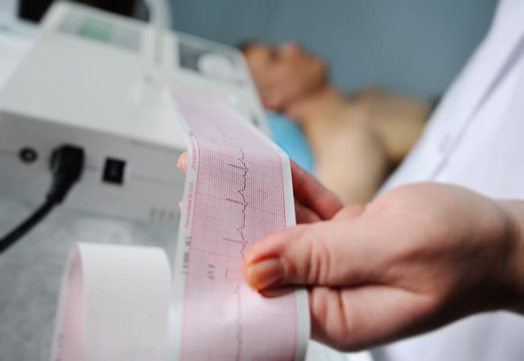 Conceito de Eletrocardiograma