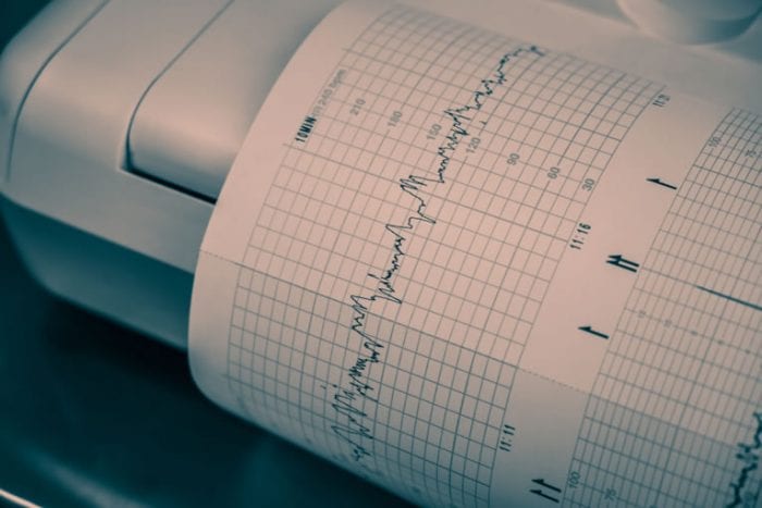 O eletrocardiógrafo com laudo a distância é confiável?