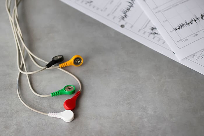 O que é um laudo de holter de ECG?