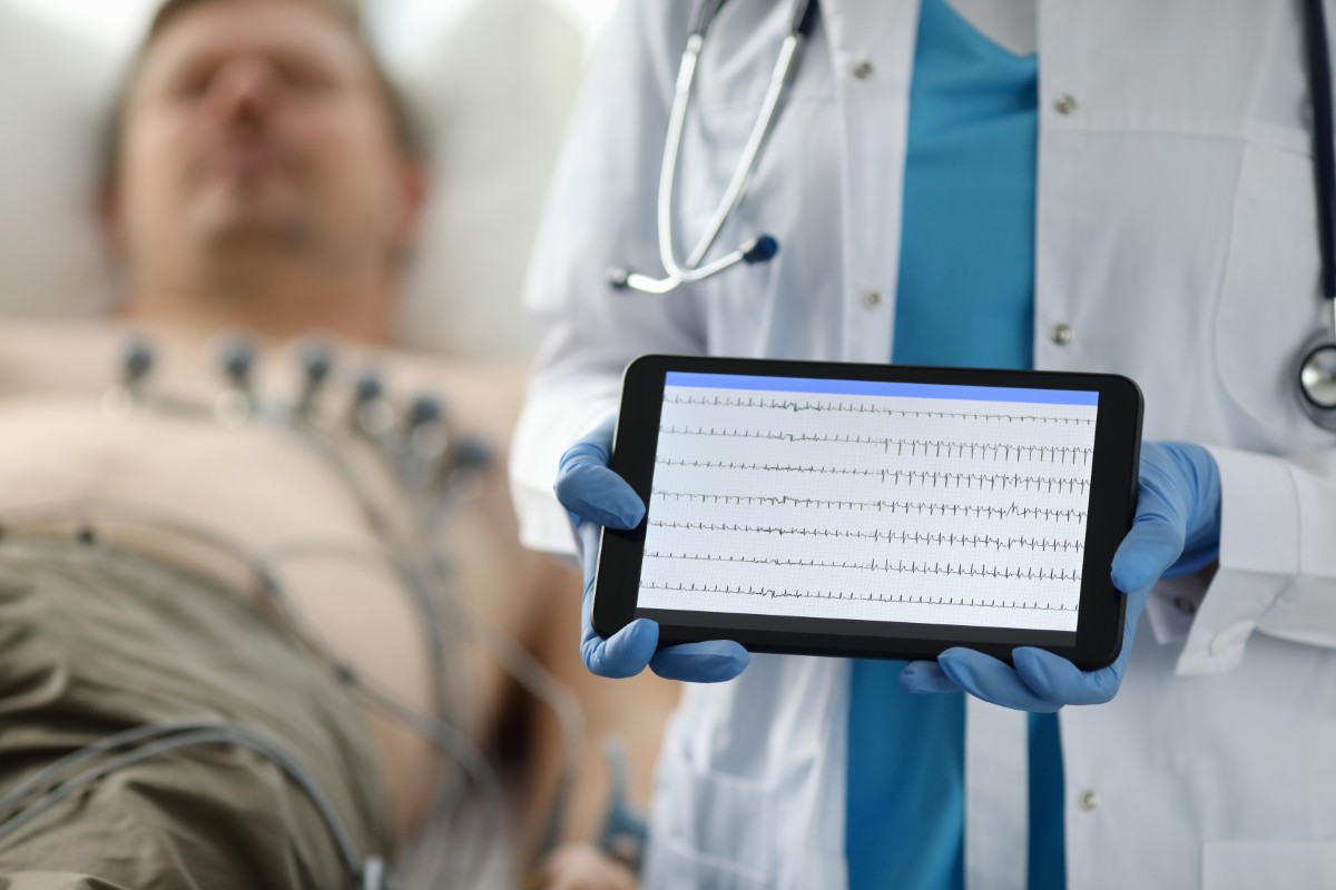 O aparelho de ECG é formado por eletrodos, cabos e um monitor Eletrocardiograma digital