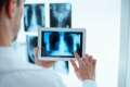 Telemedicina em Cardiologia telecardiologia com laudo ECG