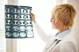 Telemedicina neurológica