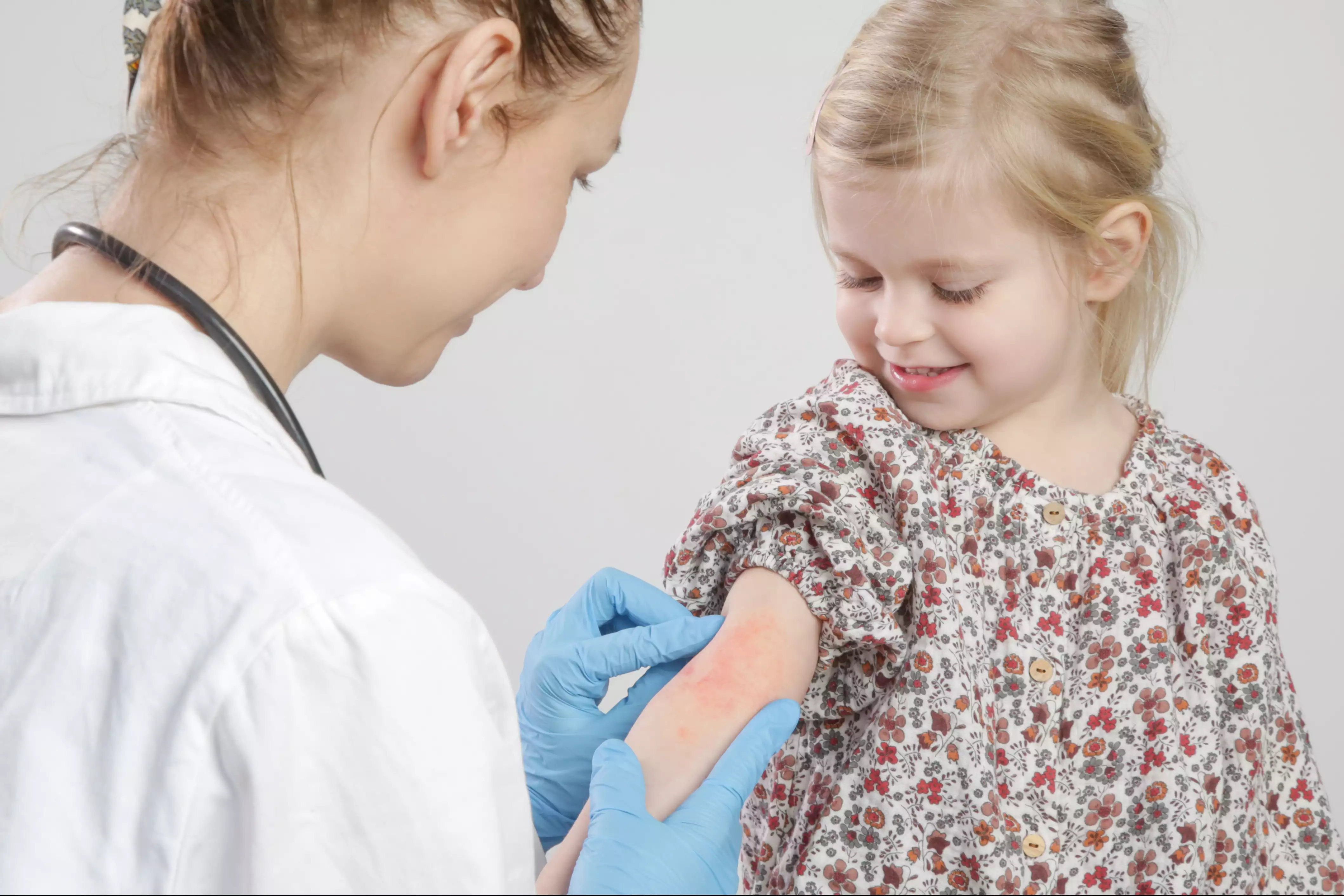 O que é dermatite atópica e como identificar, tratar e prevenir?