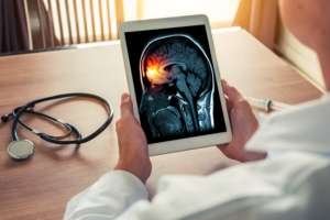 Tudo que você precisa saber sobre meningite