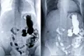 Telemedicina em Cardiologia telecardiologia com laudo ECG
