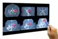 Telemedicina em Cardiologia telecardiologia com laudo ECG