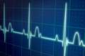Telemedicina em Cardiologia telecardiologia com laudo ECG