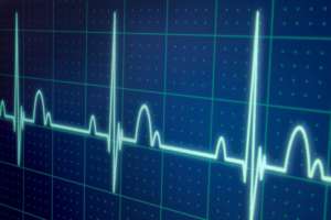 Repolarização ventricular