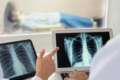 Telemedicina em Cardiologia telecardiologia com laudo ECG