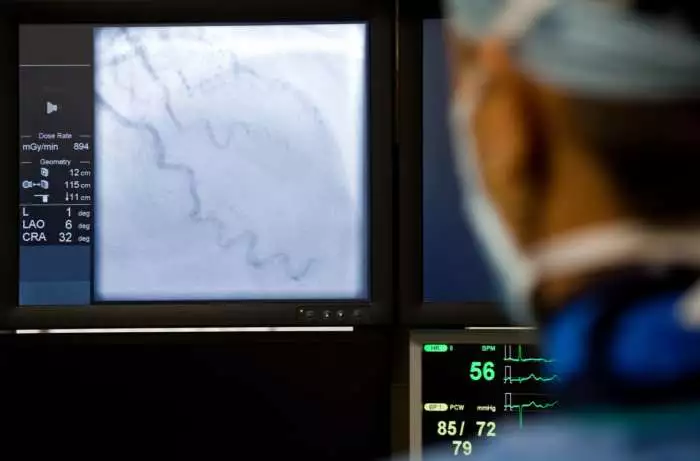Arteriografia: indicações do exame e como ele é feito