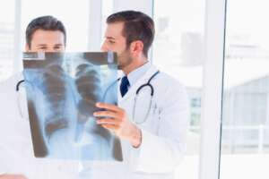 Raio x pneumonia