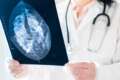Telemedicina em Cardiologia telecardiologia com laudo ECG