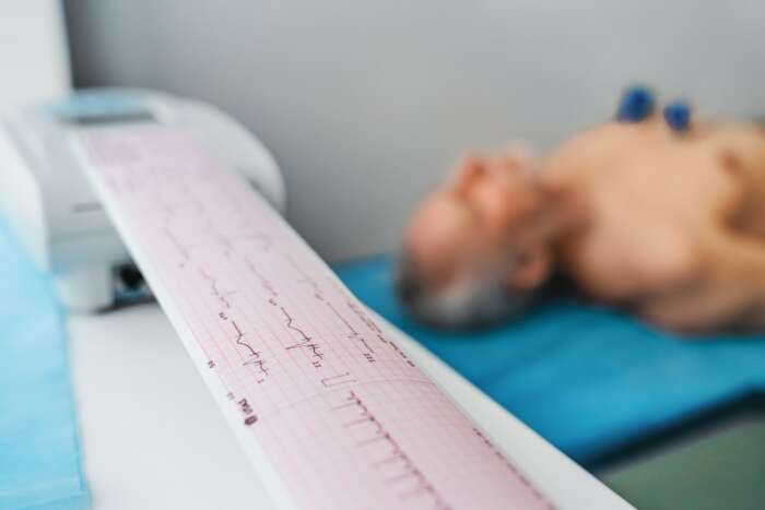 SomnoPulse™ Bracelet Anti-Ronflements | Stoppe 97 % des ronflements en 24h – sans CPAP ni chirurgie !