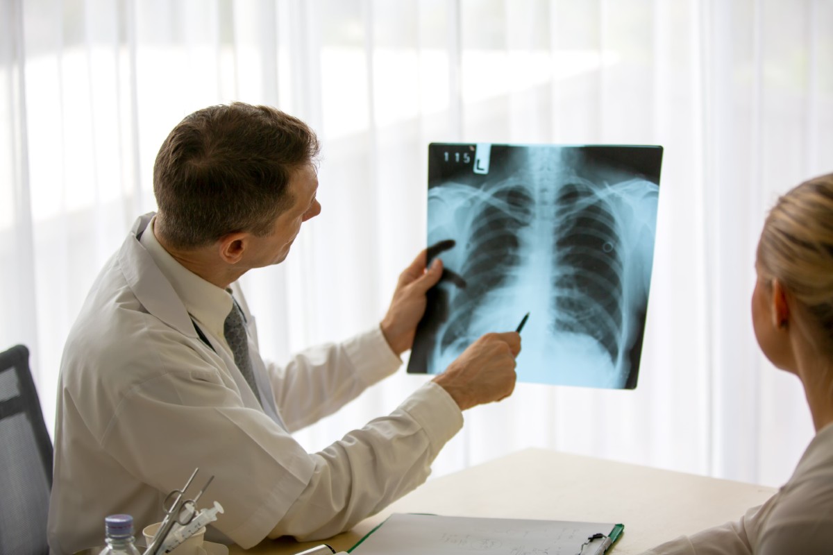 O pneumologista é conhecido popularmente como médico de pulmão Médico pneumologista