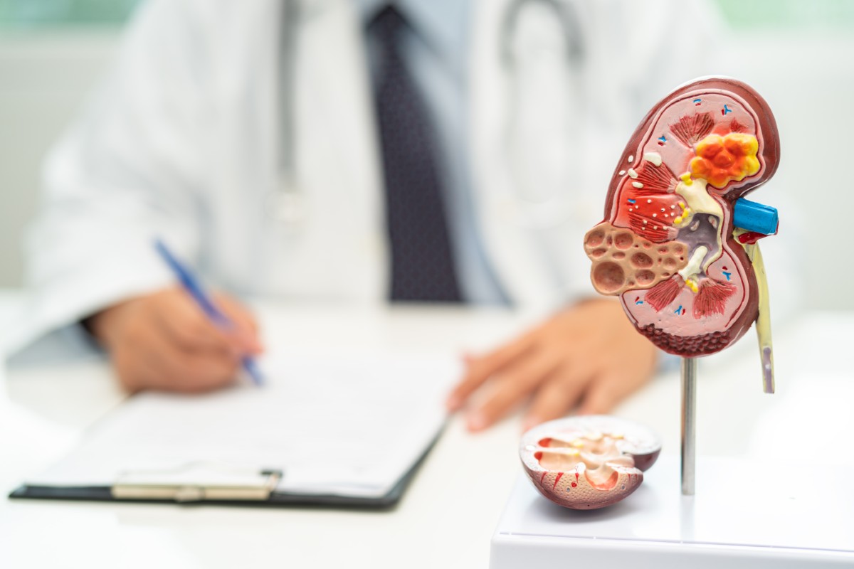 Pedra nos rins