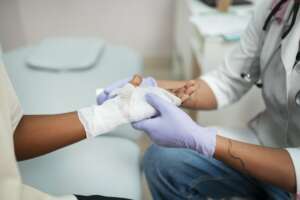 Pode estourar bolha de queimadura