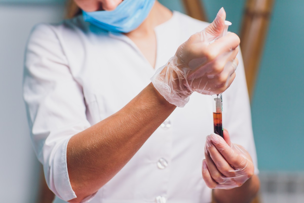 Infecção no sangue sepse