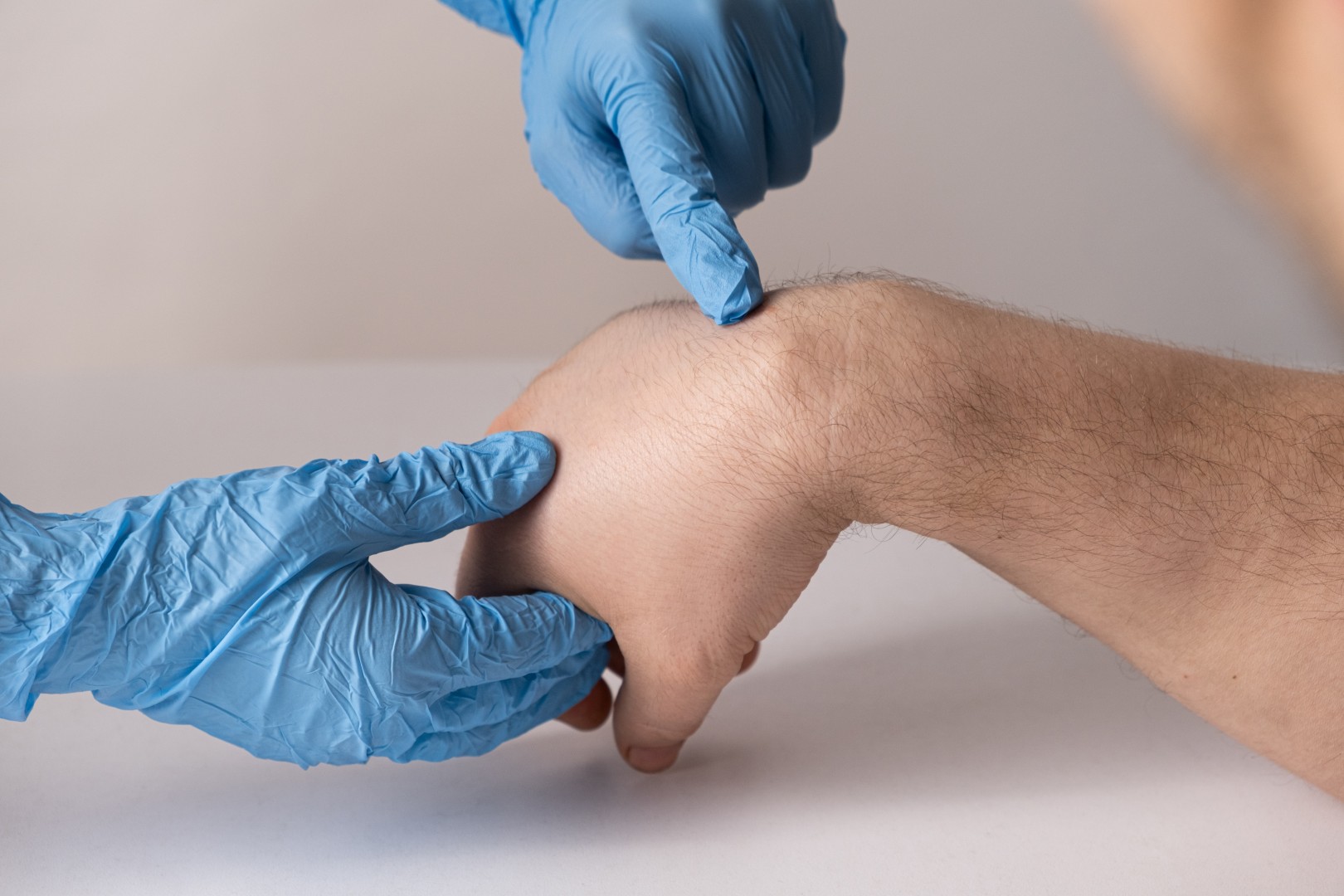 Lipoma