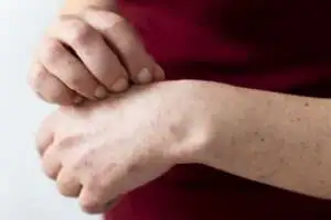 Bolinhas vermelhas no corpo
