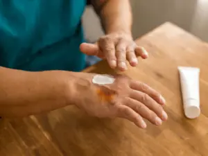 Pomada para queimadura