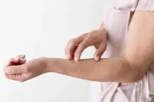 Rash cutâneo